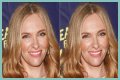 Toni Collette Teeth Before And After | What Is Wrong With Her Face